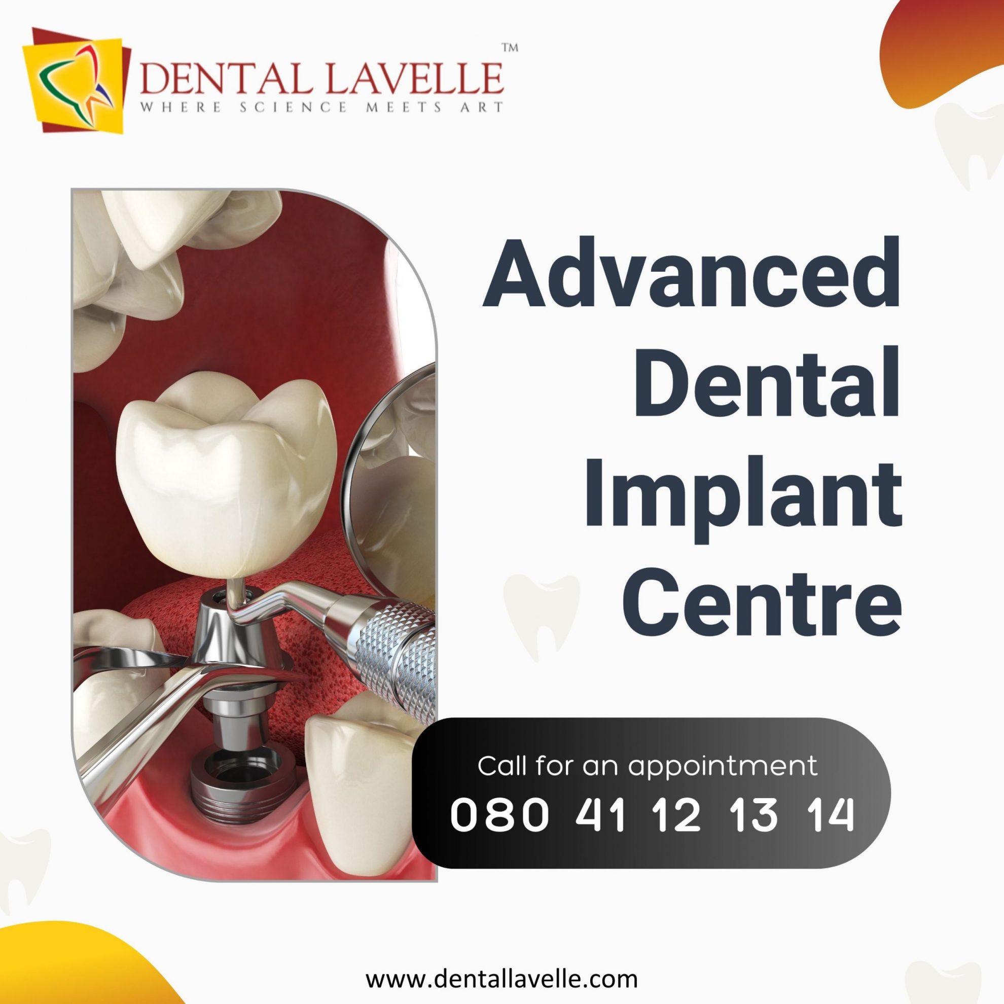 Dental Implant Im Bangalore
